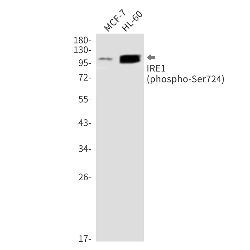 Phospho-IRE1 (Ser724) Rabbit mAb